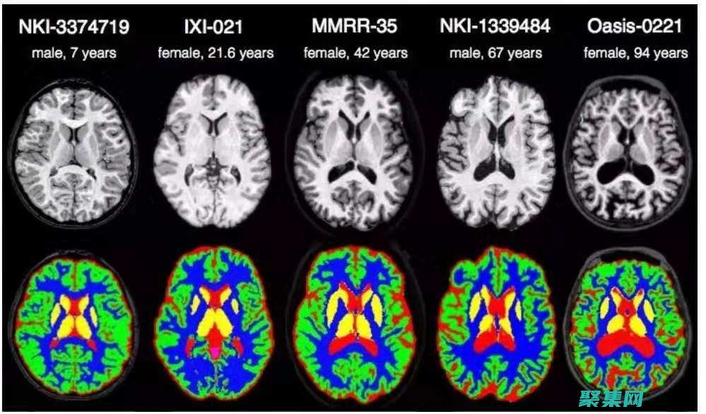 圖像處理在醫療保健中的