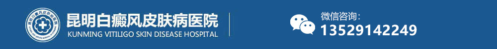 昆明白癜風醫院-昆明白癜風醫院哪家好|治療費用-昆明白癜風?？漆t院
